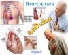 حملات قلبی در خانم ها و آقایان