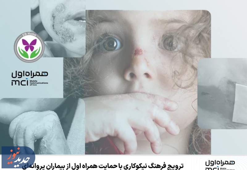 ترویج فرهنگ نیکوکاری با حمایت همراه اول از بیماران پروانه‌ای