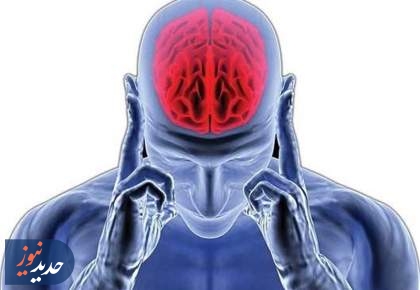 علائم و مراحل آغاز آلزایمر چیست؟