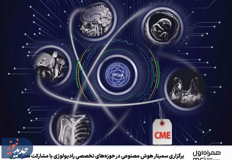 برگزاری سمینار هوش مصنوعی در حوزه‌های تخصصی رادیولوژی